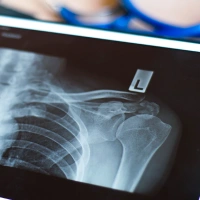img-servicios-Radiología